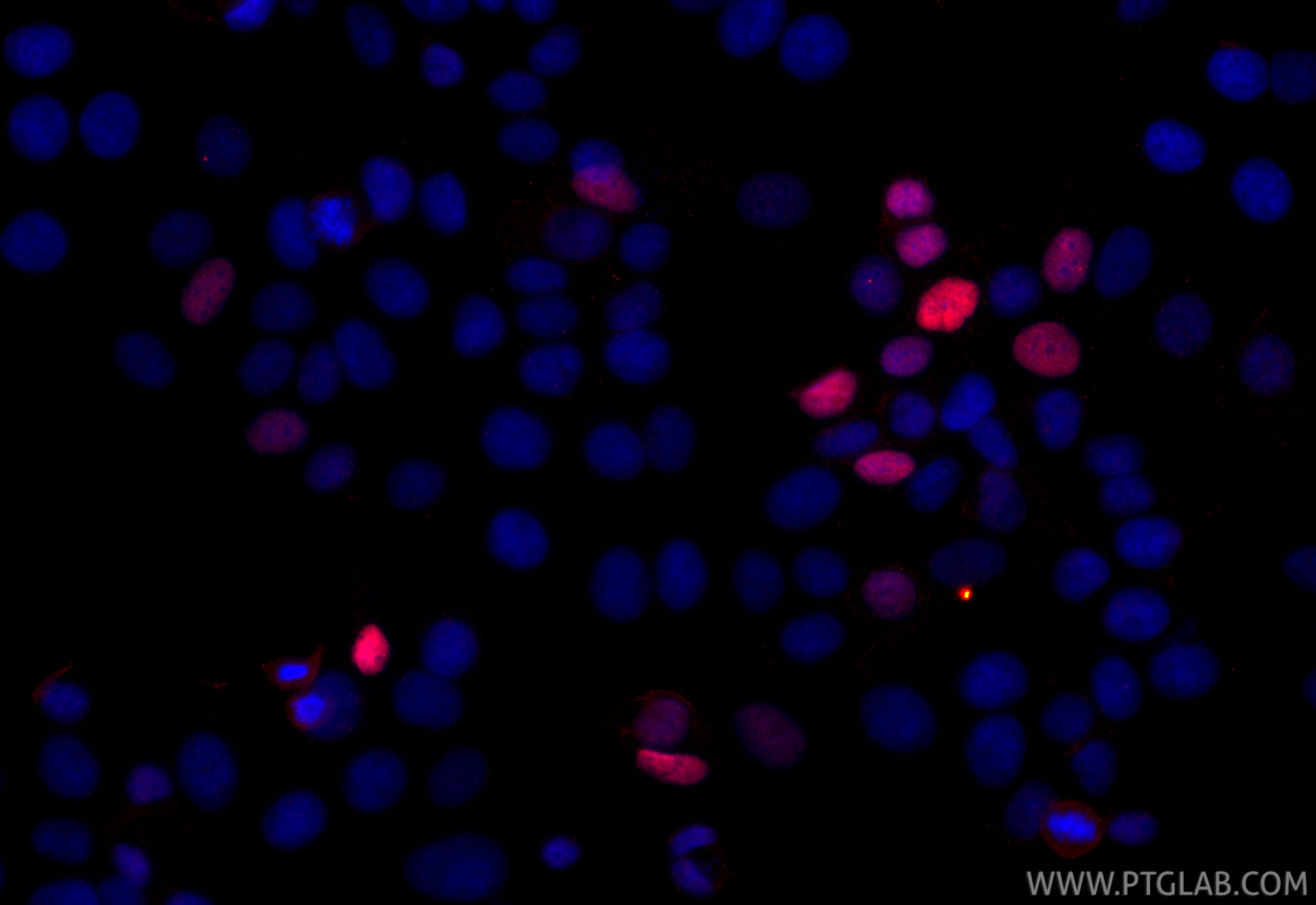 Immunofluorescence (IF) / fluorescent staining of MCF-7 cells using CoraLite®594-conjugated P21 Recombinant antibody (CL594-82669-2)