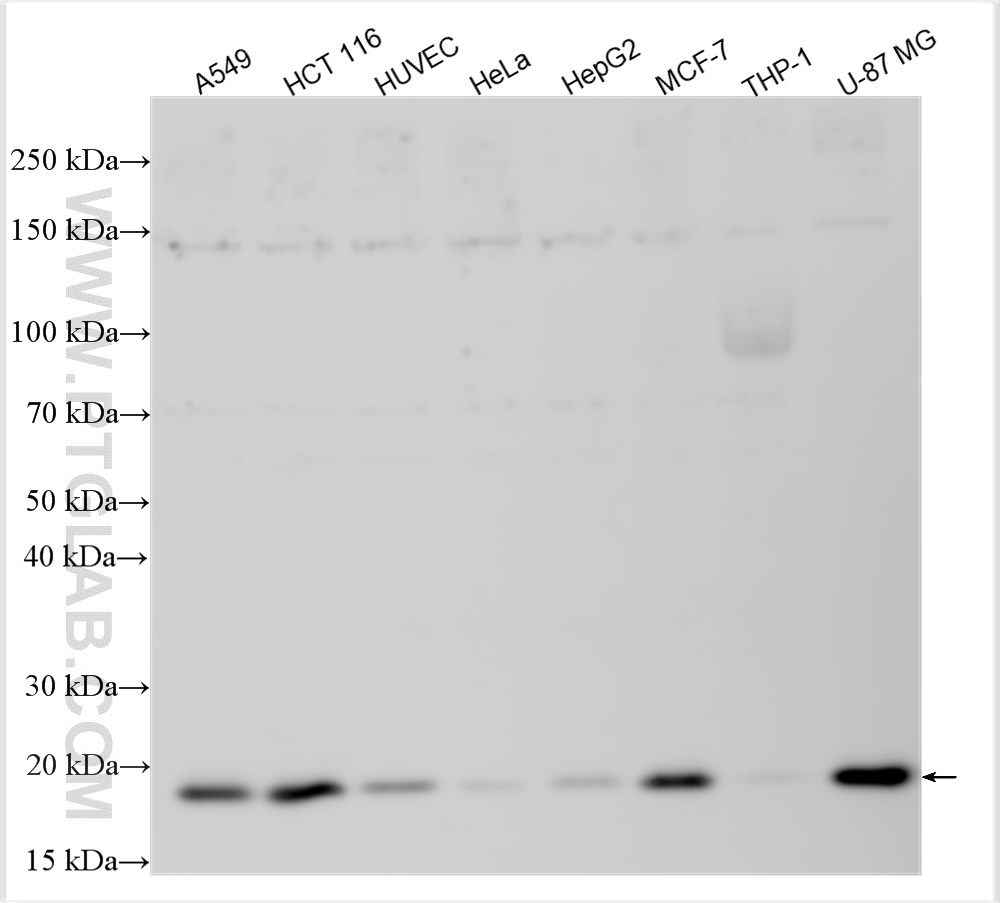 Western Blot (WB) analysis of various lysates using P21 Recombinant antibody (82669-2-RR)