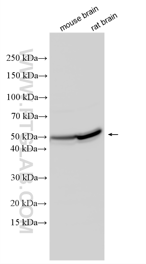 Western Blot (WB) analysis of various lysates using P2RX5 Polyclonal antibody (19012-1-AP)
