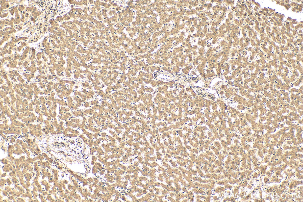 Immunohistochemistry (IHC) staining of human liver tissue using P4HA3 Polyclonal antibody (23185-1-AP)