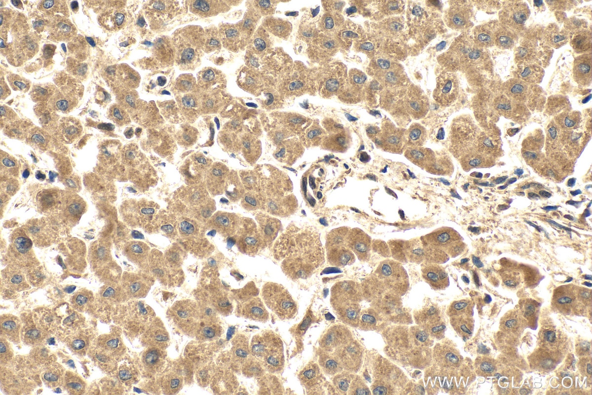 Immunohistochemistry (IHC) staining of human liver tissue using P4HA3 Polyclonal antibody (23185-1-AP)