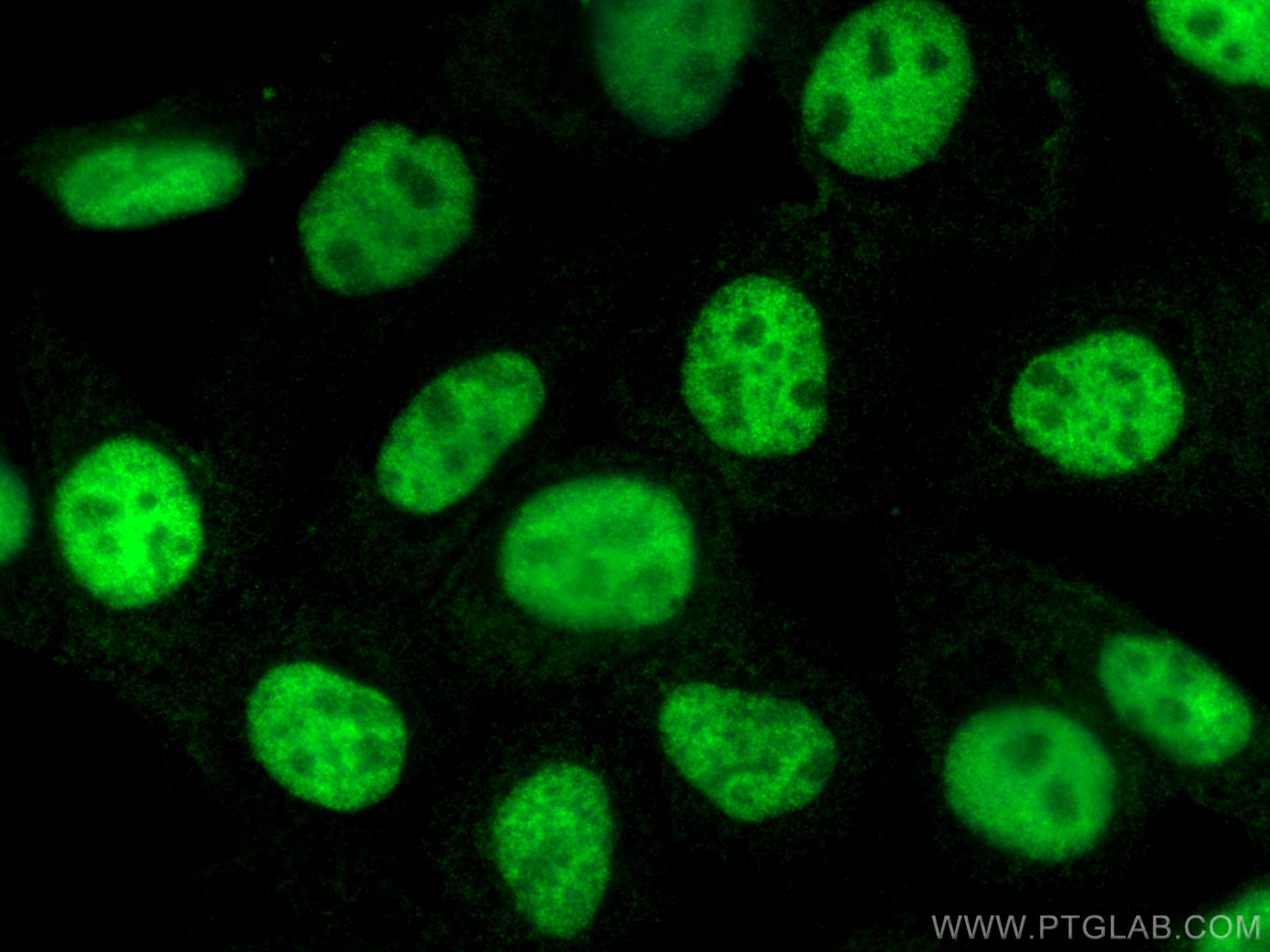 Immunofluorescence (IF) / fluorescent staining of A431 cells using P53 Polyclonal antibody (10442-1-AP)