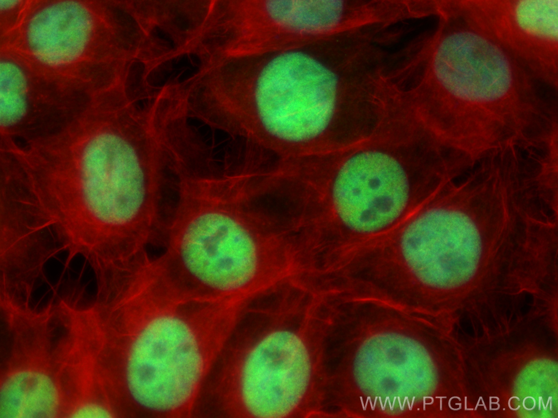 Immunofluorescence (IF) / fluorescent staining of A431 cells using P53 Monoclonal antibody (60283-2-Ig)