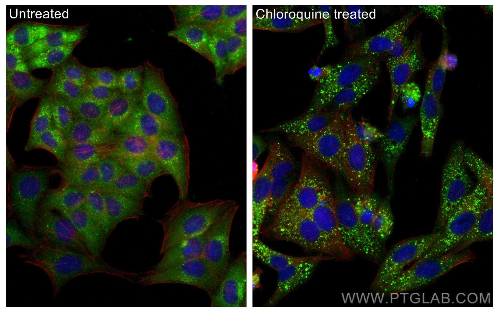 Immunofluorescence (IF) / fluorescent staining of HepG2 cells using P62,SQSTM1 Polyclonal antibody (31403-1-AP)