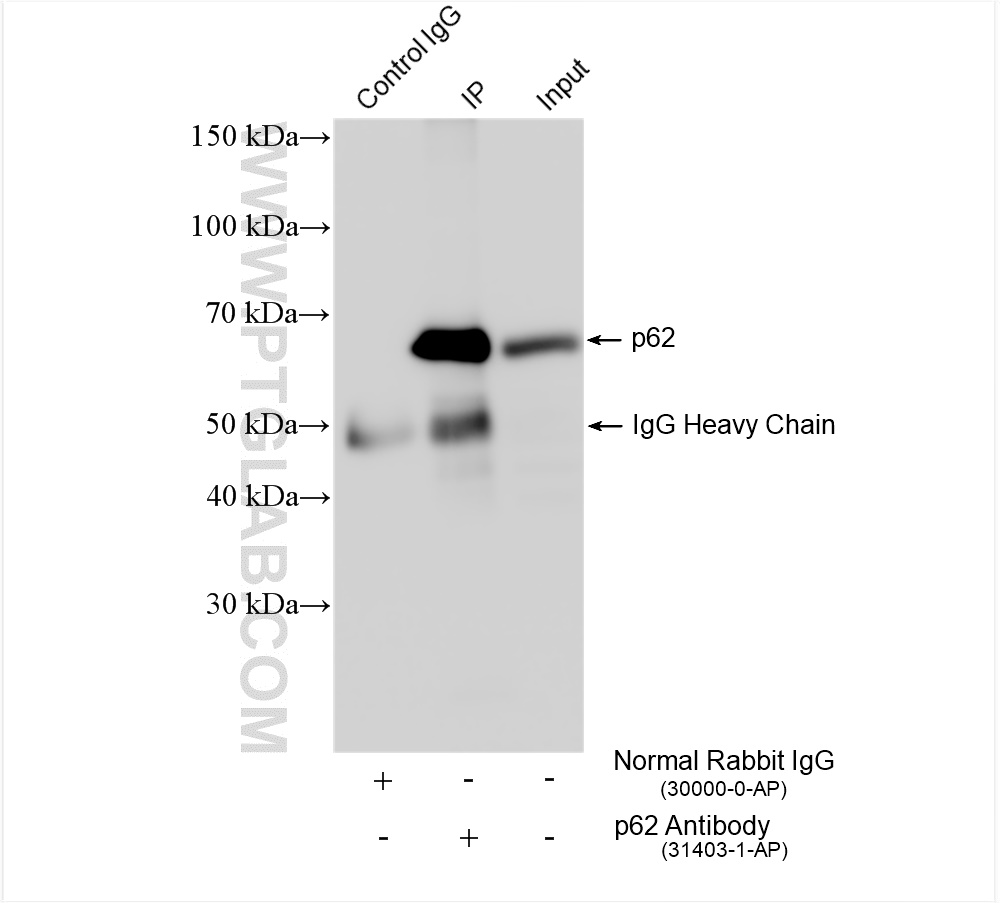 Immunoprecipitation (IP) experiment of NIH/3T3 cells using P62,SQSTM1 Polyclonal antibody (31403-1-AP)