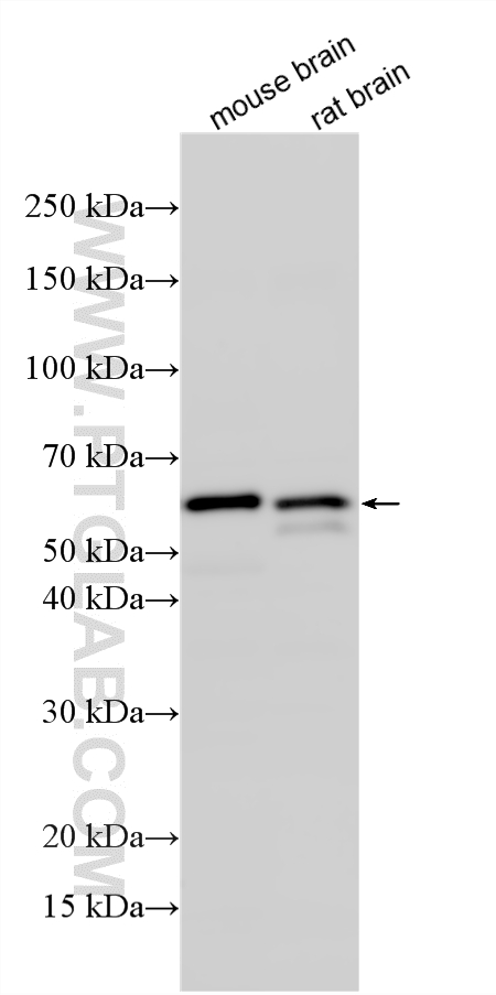 Western Blot (WB) analysis of various lysates using P62/SQSTM1 Polyclonal antibody (31403-1-AP)