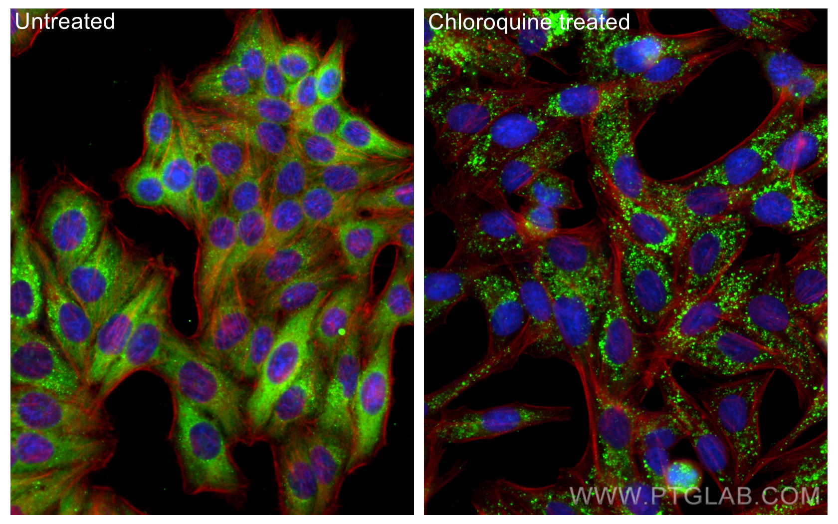 Immunofluorescence (IF) / fluorescent staining of HepG2 cells using P62/SQSTM1 Monoclonal antibody (66184-1-Ig)