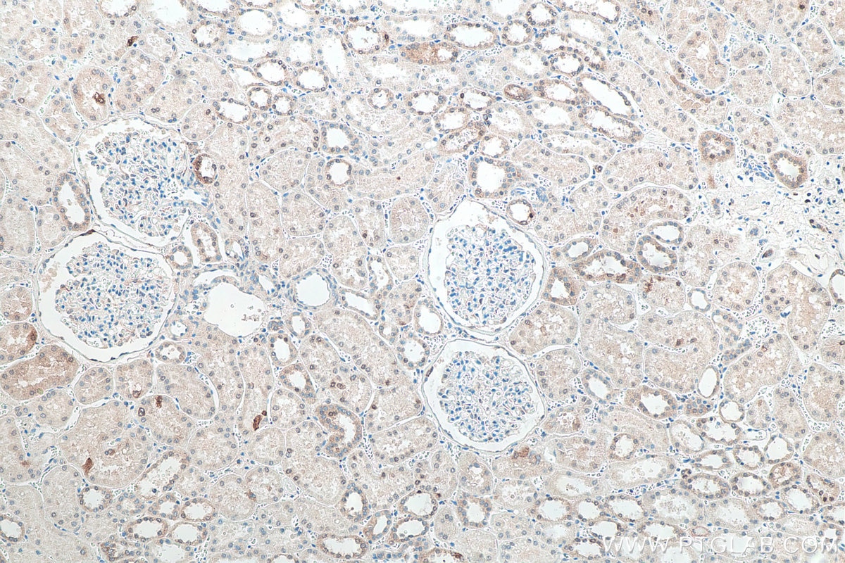 Immunohistochemistry (IHC) staining of human kidney tissue using P62/SQSTM1 Monoclonal antibody (66184-1-Ig)