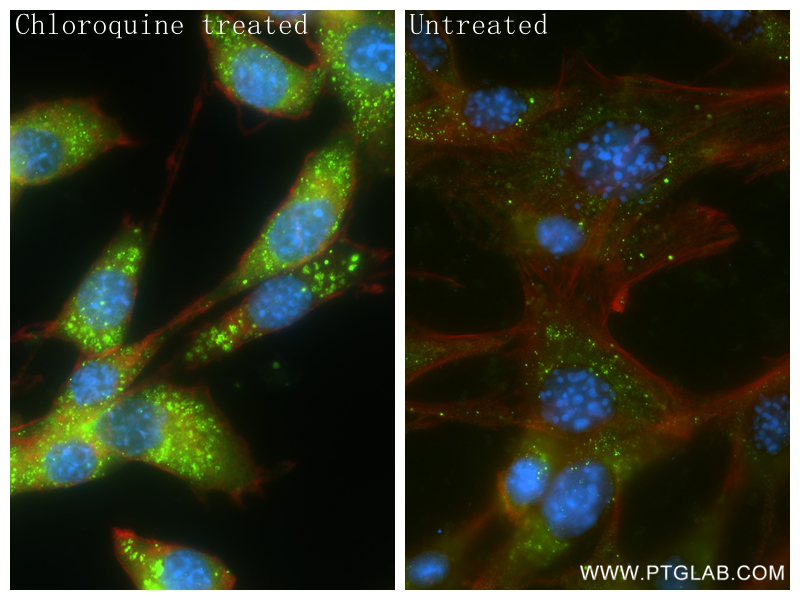 Immunofluorescence (IF) / fluorescent staining of NIH/3T3 cells using P62,SQSTM1 Recombinant antibody (84826-1-RR)