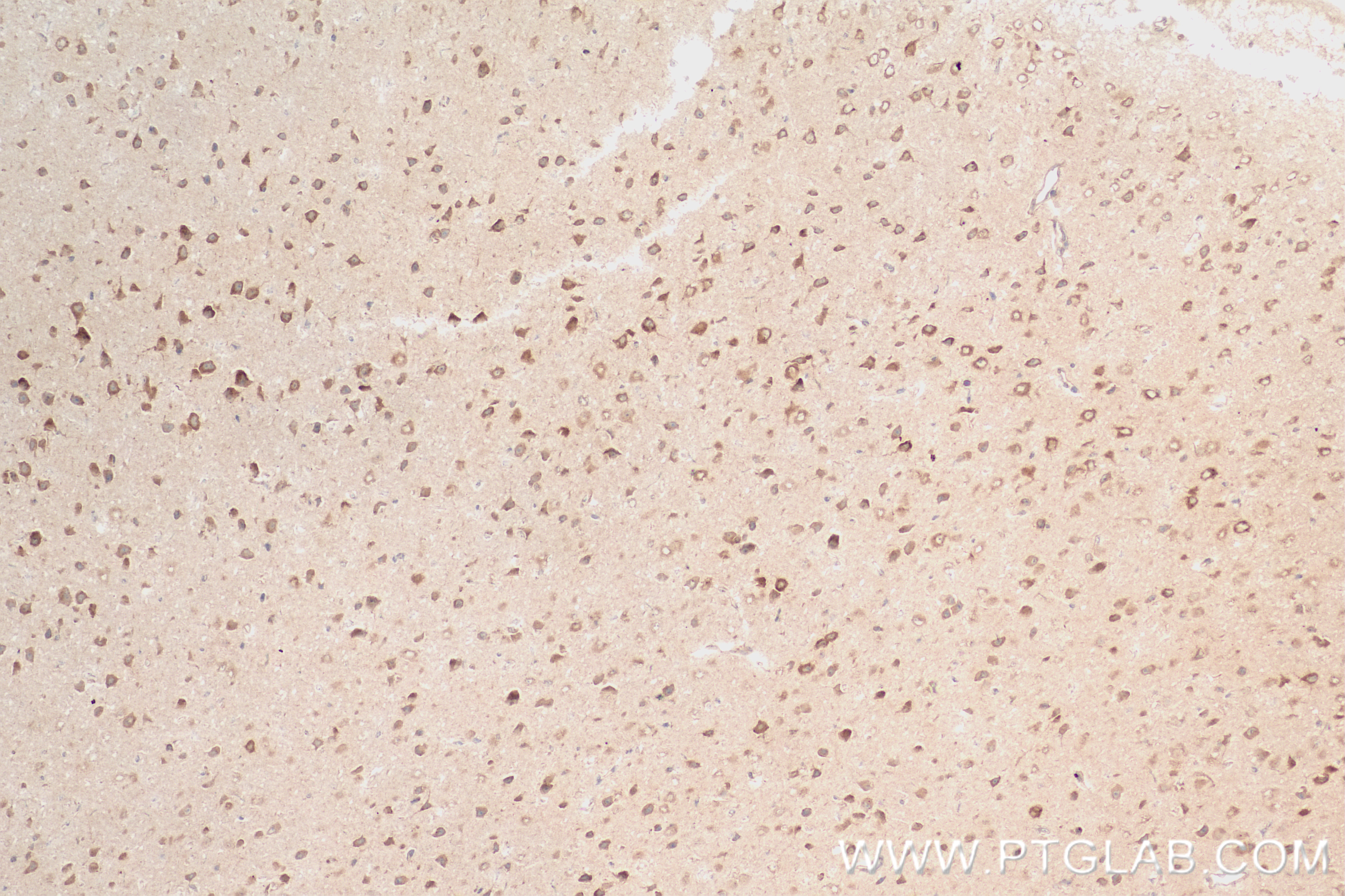 Immunohistochemistry (IHC) staining of mouse brain tissue using P62,SQSTM1 Recombinant antibody (84826-1-RR)