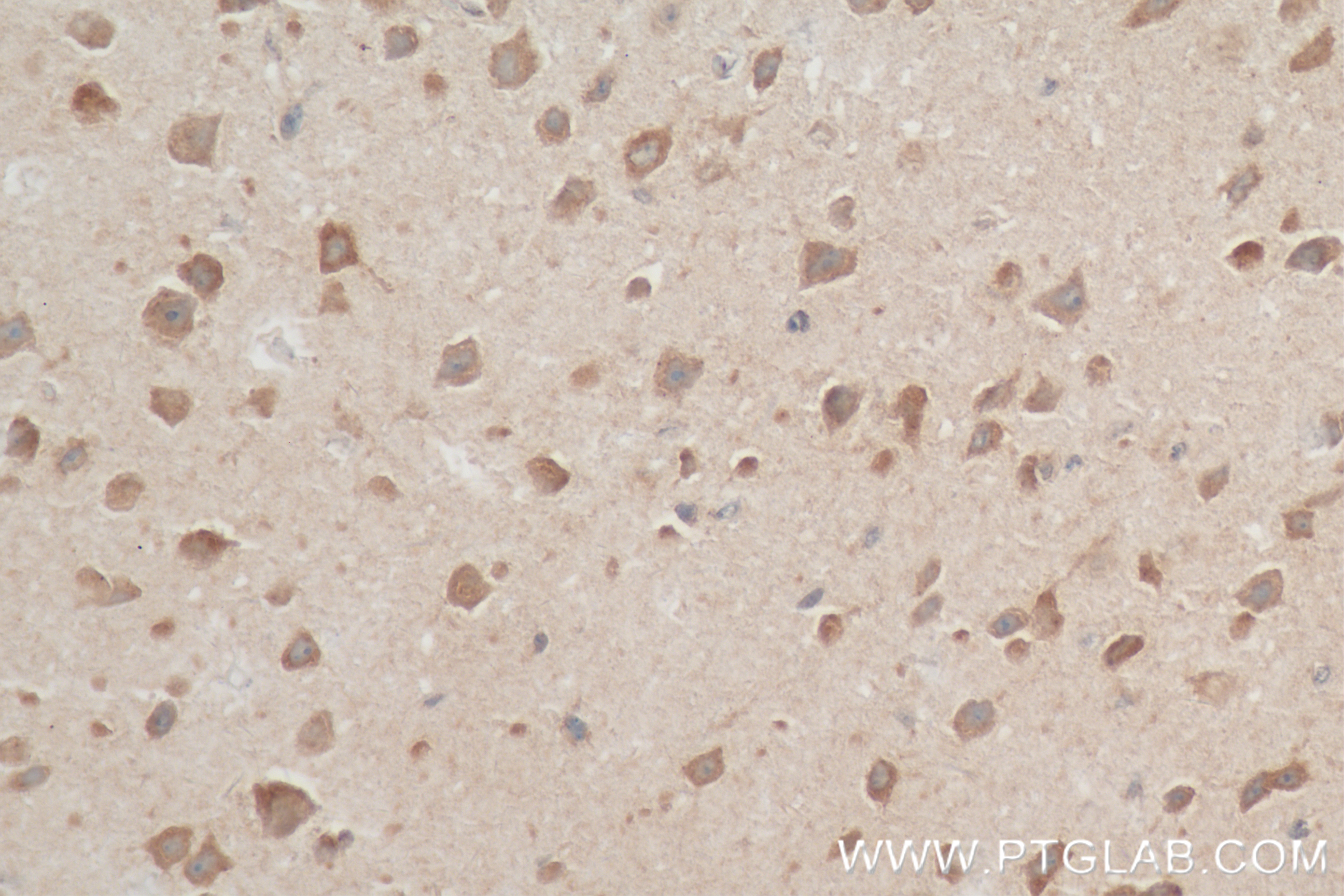 Immunohistochemistry (IHC) staining of mouse brain tissue using P62,SQSTM1 Recombinant antibody (84826-1-RR)