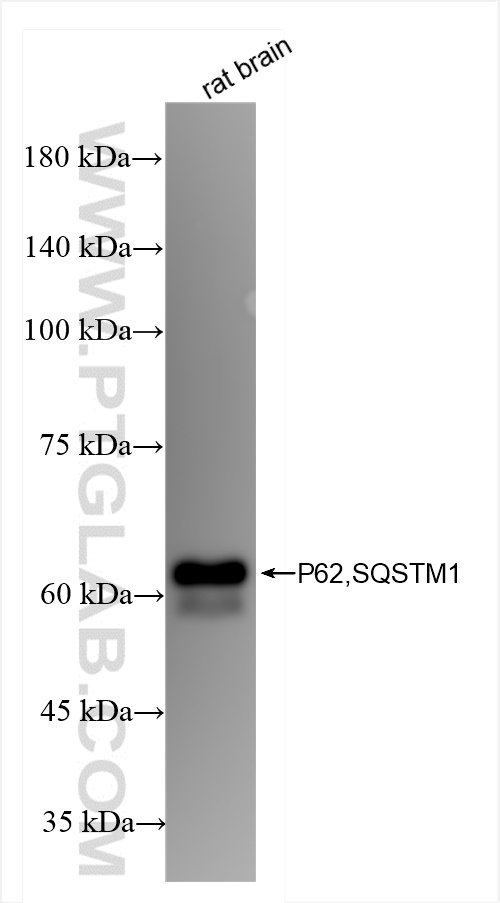 Western Blot (WB) analysis of rat brain tissue using P62,SQSTM1 Recombinant antibody (84826-1-RR)