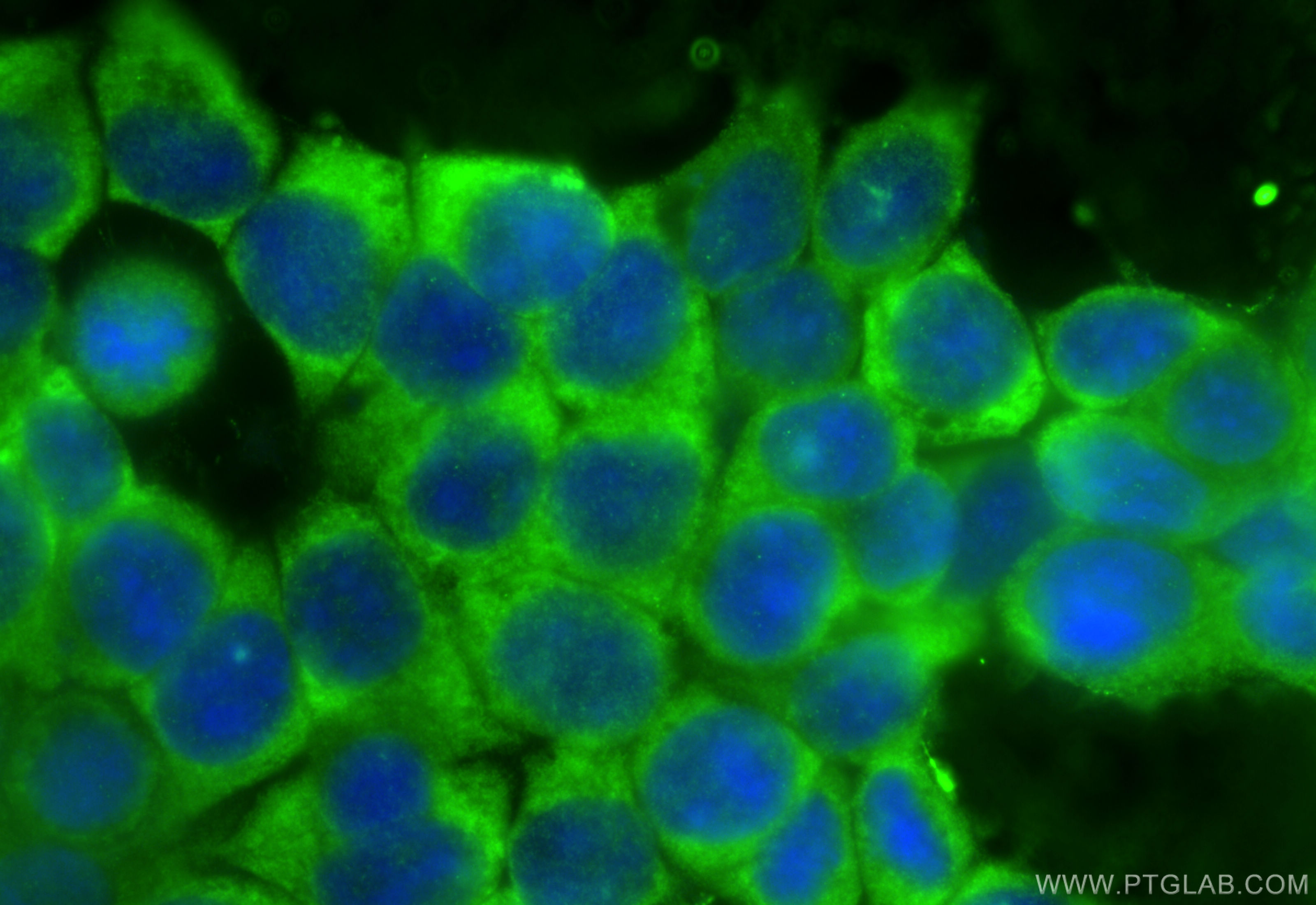 Immunofluorescence (IF) / fluorescent staining of MCF-7 cells using PABPC1,PABP Polyclonal antibody (10970-1-AP)