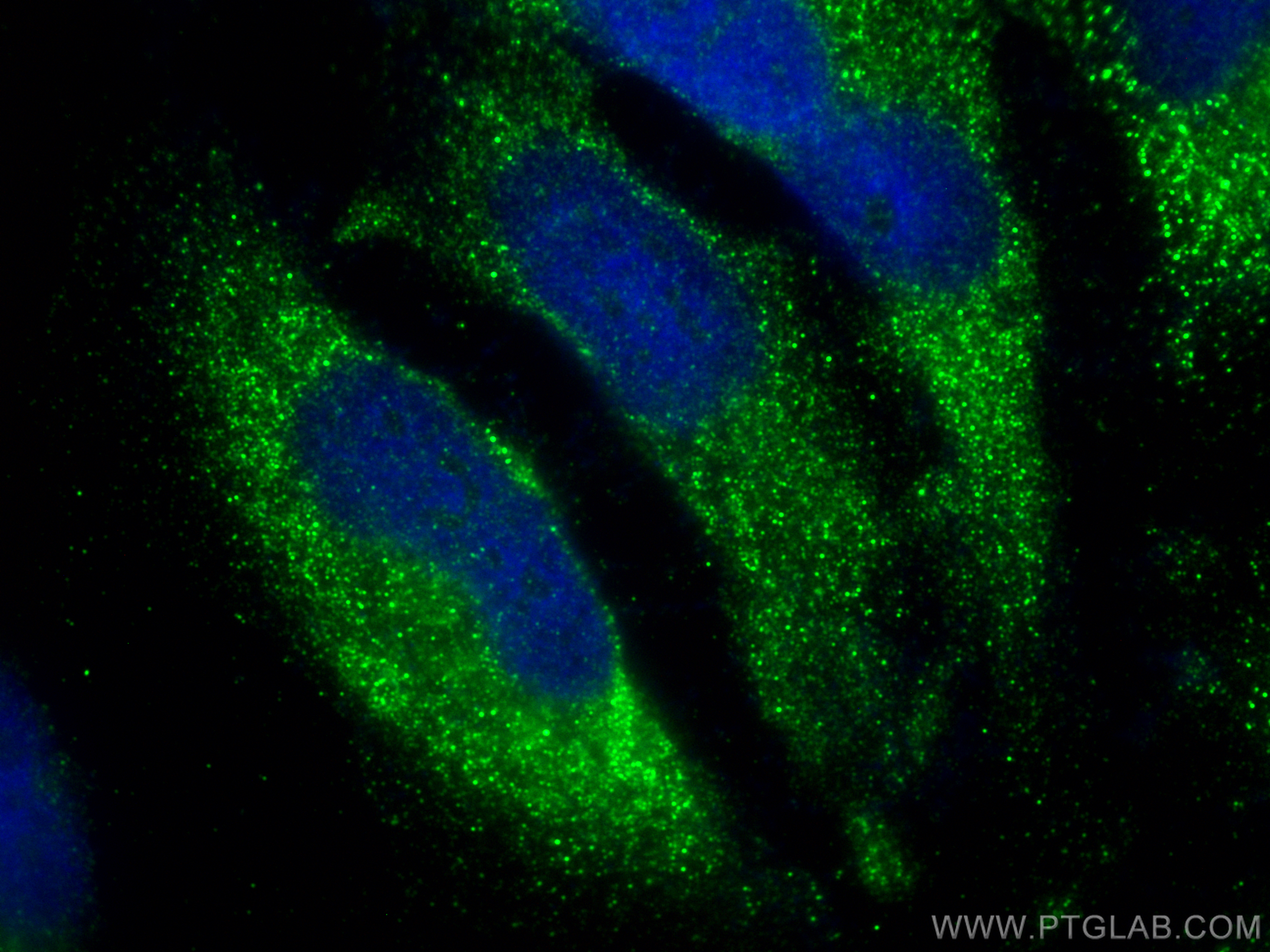 Immunofluorescence (IF) / fluorescent staining of HeLa cells using PABPC5 Polyclonal antibody (25582-1-AP)