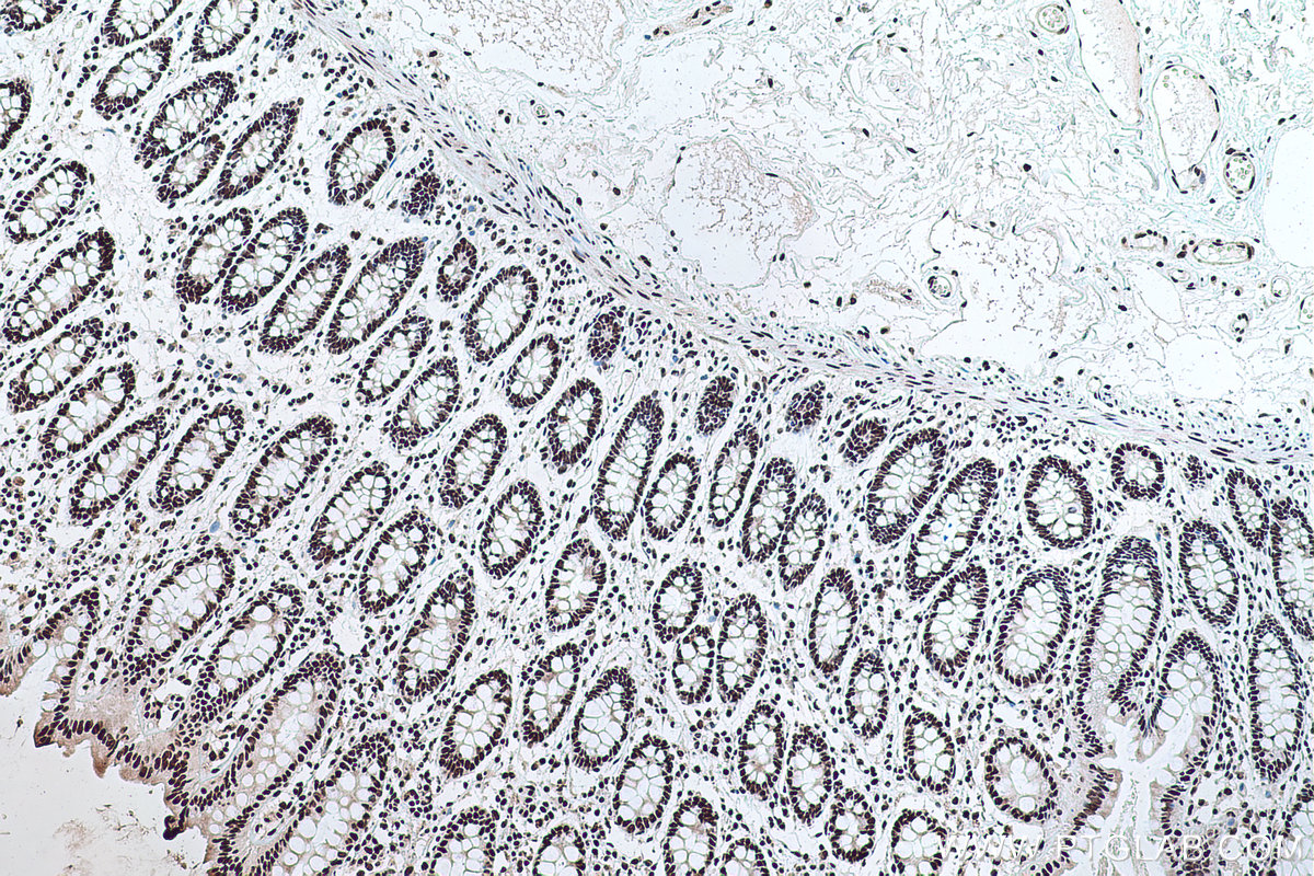 Immunohistochemistry (IHC) staining of human colon tissue using PABPN1 Monoclonal antibody (66807-1-Ig)