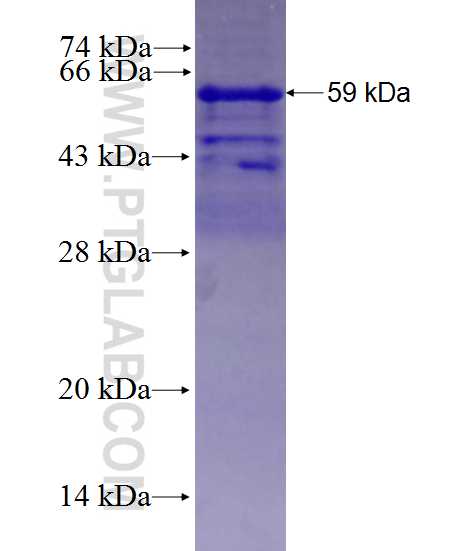 PABPN1 fusion protein Ag27814 SDS-PAGE