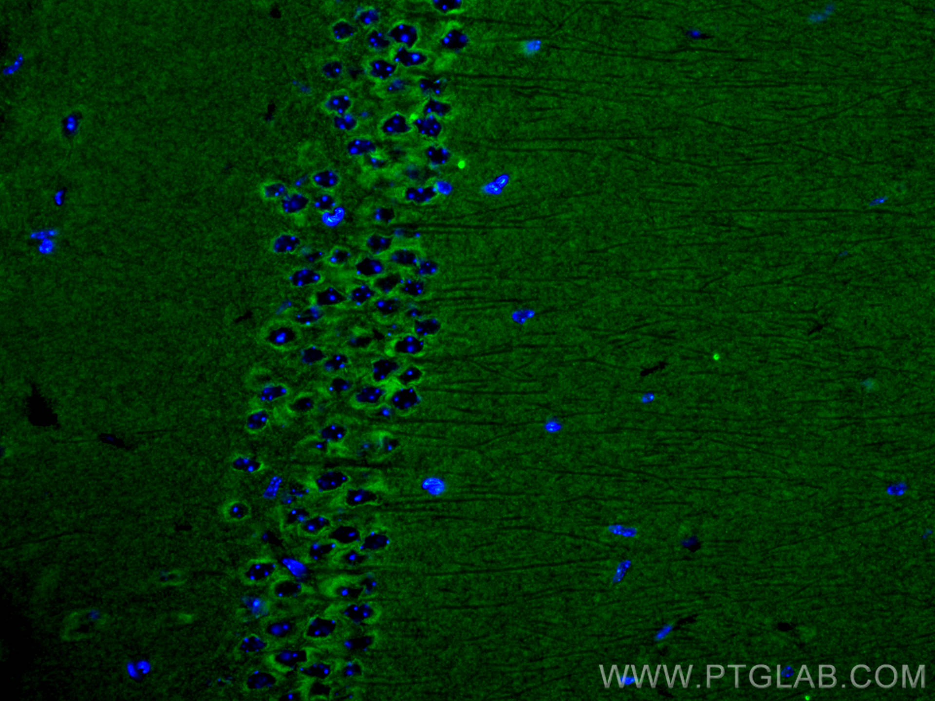 Immunofluorescence (IF) / fluorescent staining of mouse brain tissue using PACSIN1 Monoclonal antibody (68115-1-Ig)