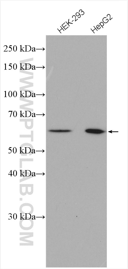 Western Blot (WB) analysis of various lysates using PACSIN2 Polyclonal antibody (10518-2-AP)