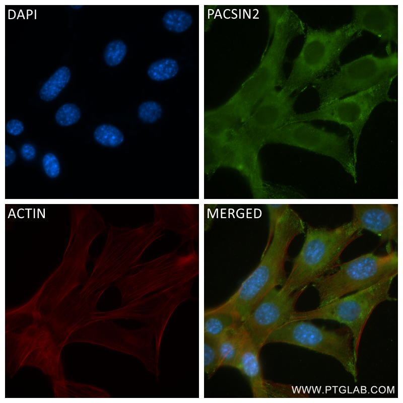 Immunofluorescence (IF) / fluorescent staining of NIH/3T3 cells using PACSIN2 Recombinant antibody (84763-4-RR)