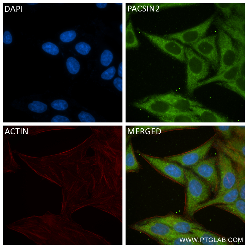 Immunofluorescence (IF) / fluorescent staining of HepG2 cells using PACSIN2 Recombinant antibody (84763-4-RR)