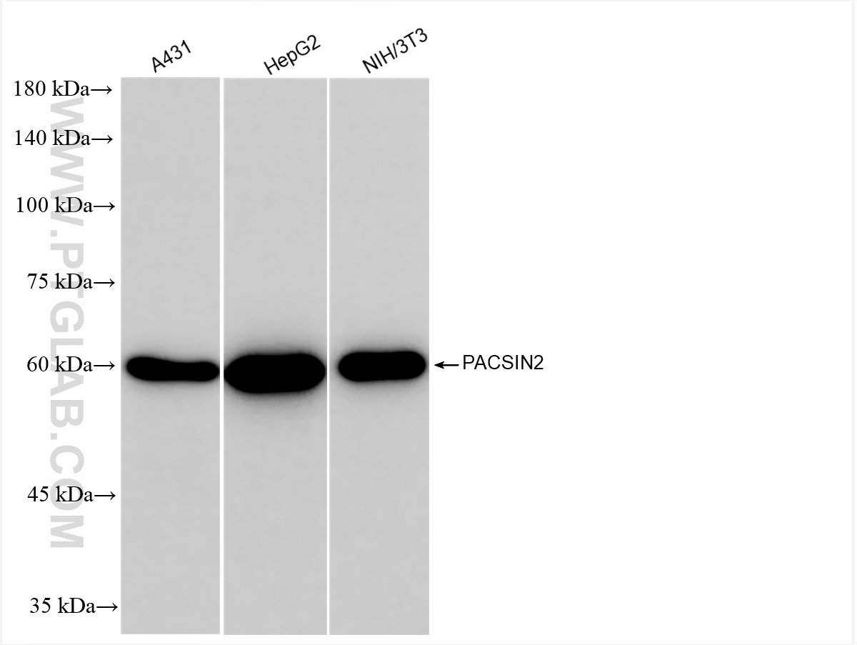 Western Blot (WB) analysis of various lysates using PACSIN2 Recombinant antibody (84763-4-RR)