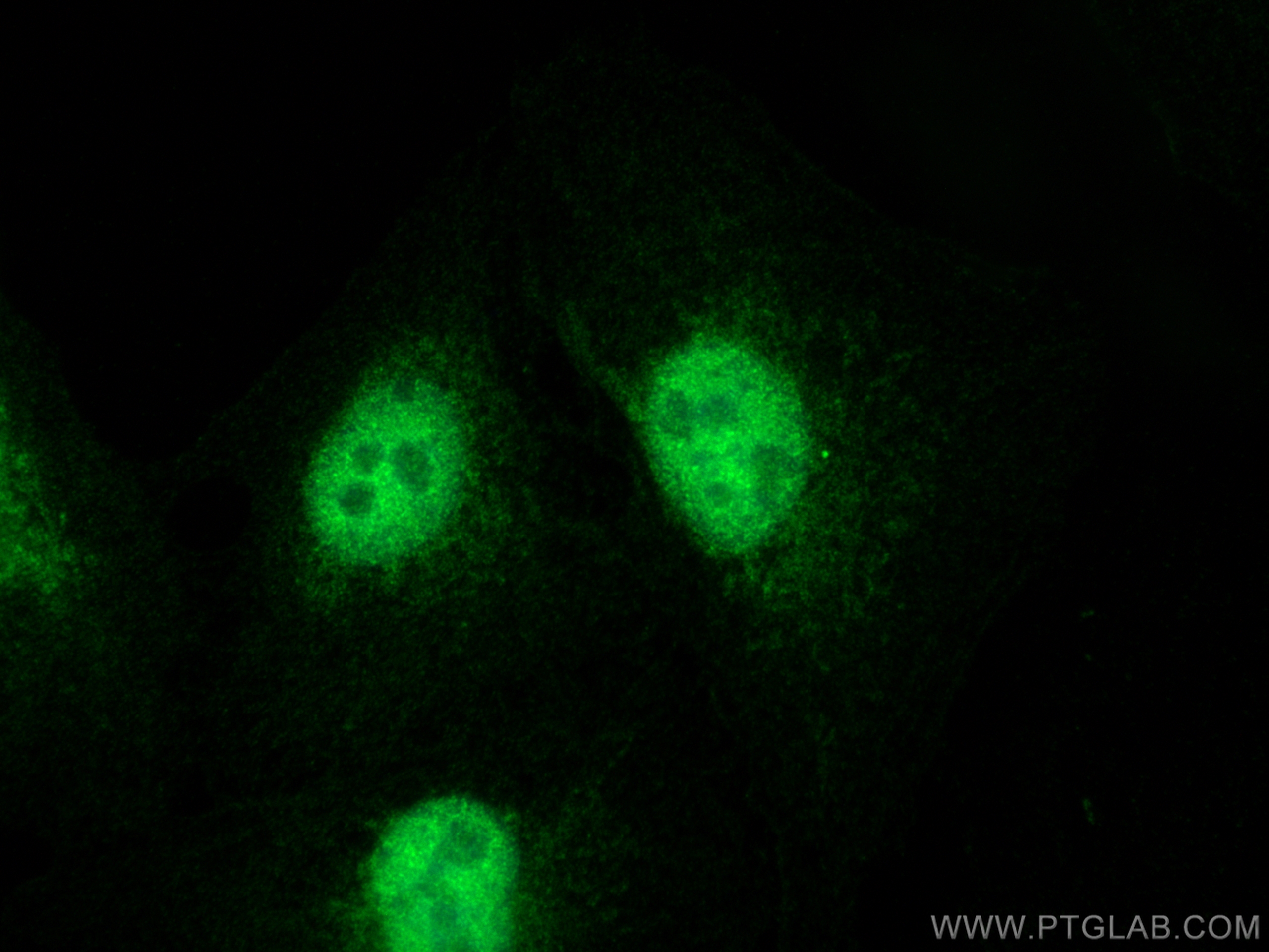 Immunofluorescence (IF) / fluorescent staining of A549 cells using PADI4 Polyclonal antibody (17373-1-AP)