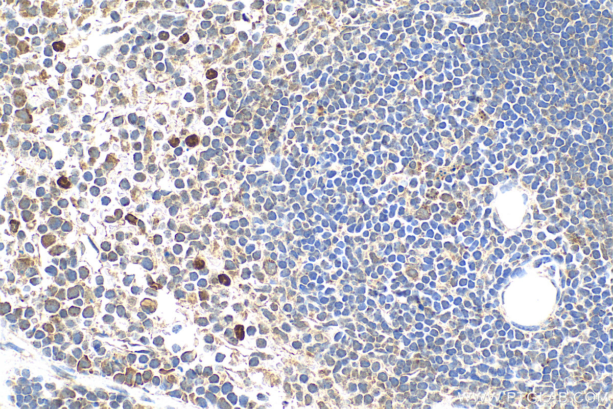 Immunohistochemistry (IHC) staining of mouse spleen tissue using PADI4 Polyclonal antibody (17373-1-AP)