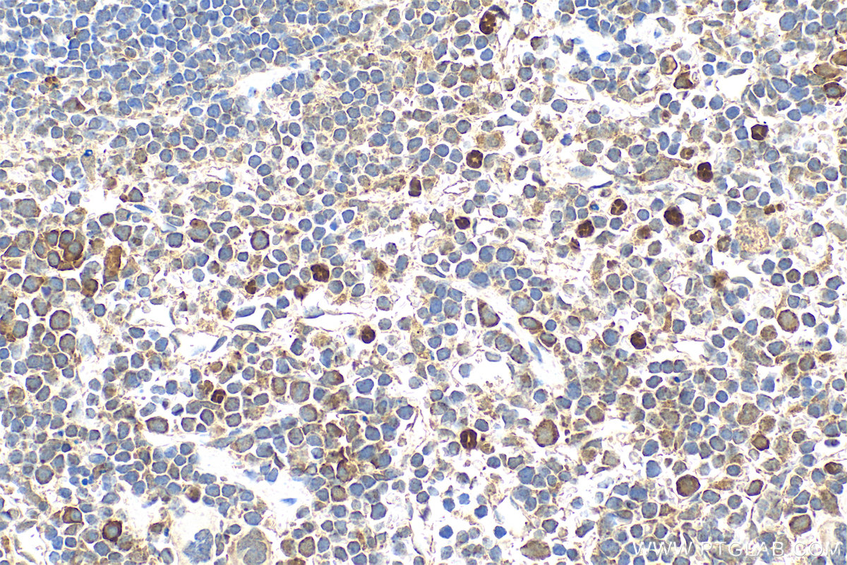 Immunohistochemistry (IHC) staining of mouse spleen tissue using PADI4 Polyclonal antibody (17373-1-AP)