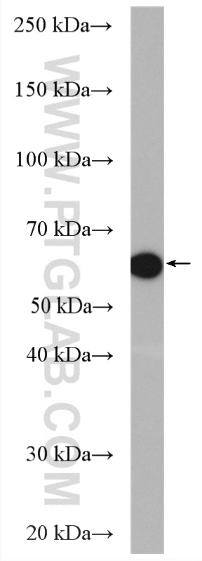 Western Blot (WB) analysis of SKOV-3 cells using PADI4 Polyclonal antibody (17373-1-AP)