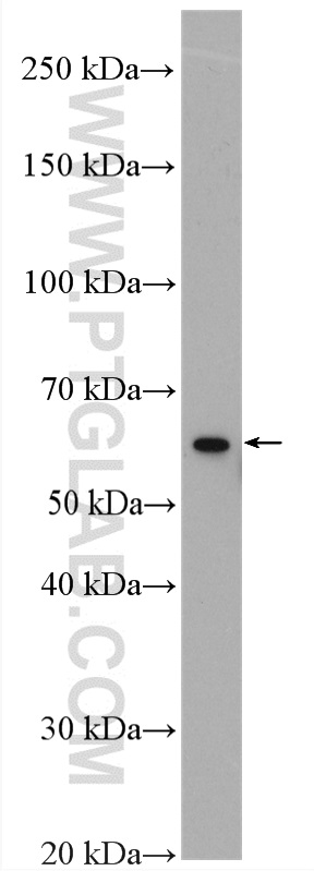 Western Blot (WB) analysis of mouse spleen tissue using PADI4 Polyclonal antibody (17373-1-AP)