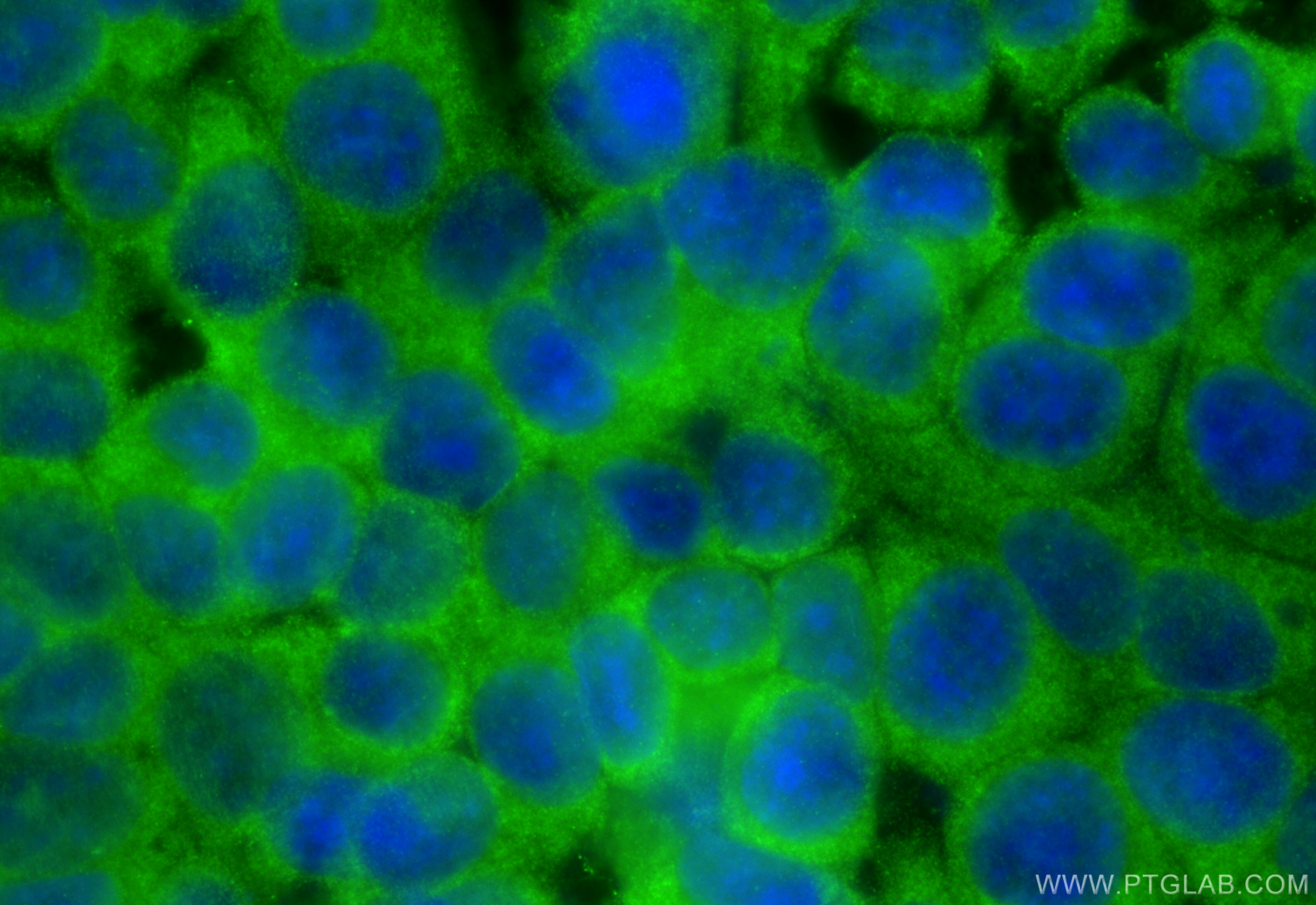 Immunofluorescence (IF) / fluorescent staining of MCF-7 cells using PAIP1 Polyclonal antibody (10675-1-AP)