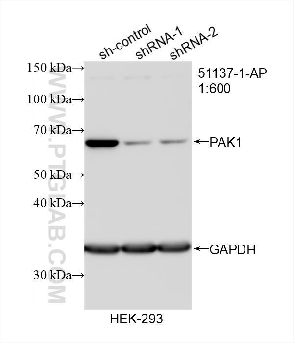 Western Blot (WB) analysis of HEK-293 cells using PAK1 Polyclonal antibody (51137-1-AP)