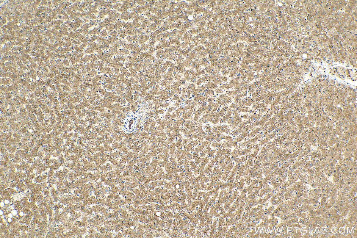 Immunohistochemistry (IHC) staining of human liver tissue using PAK4 Polyclonal antibody (14685-1-AP)