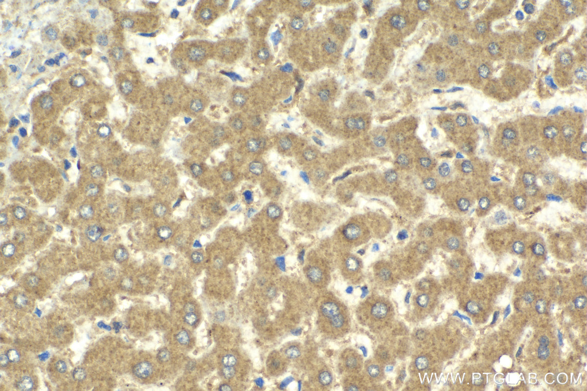 Immunohistochemistry (IHC) staining of human liver tissue using PAK4 Polyclonal antibody (14685-1-AP)