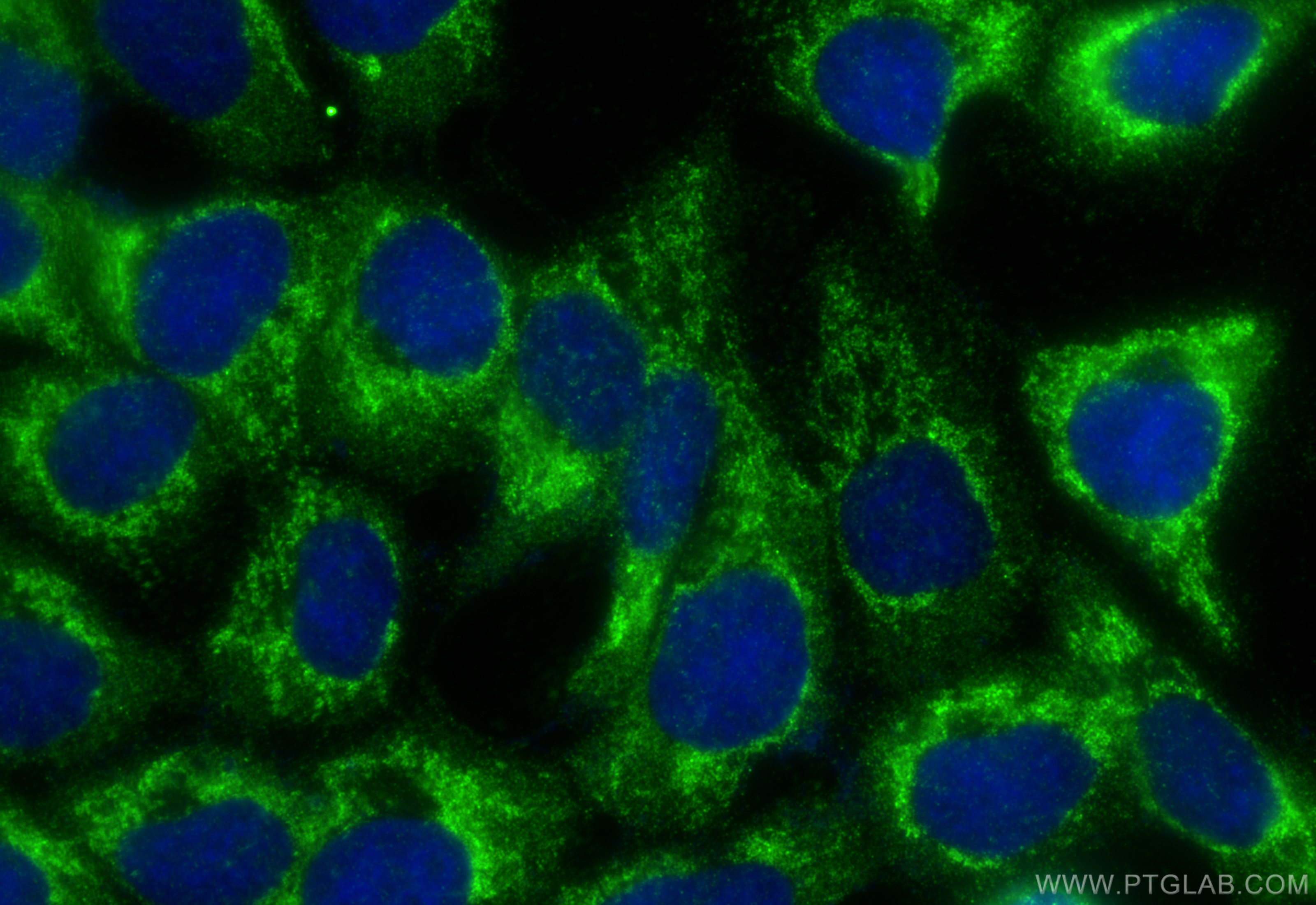 Immunofluorescence (IF) / fluorescent staining of A431 cells using PAK6 Polyclonal antibody (13539-1-AP)