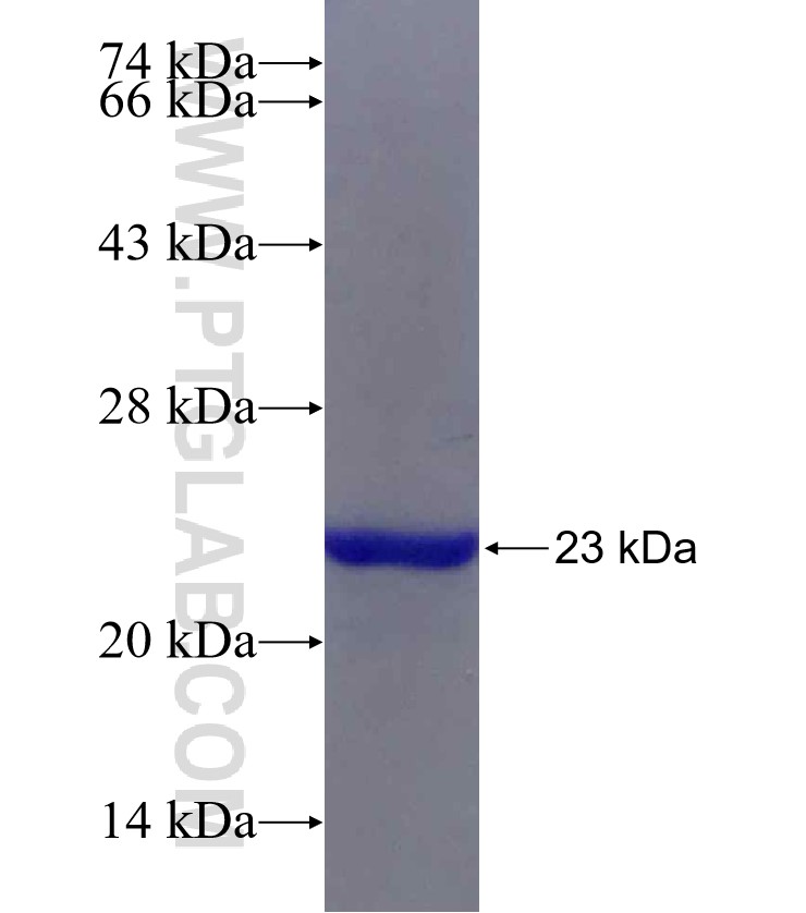 PAK6 fusion protein Ag29957 SDS-PAGE