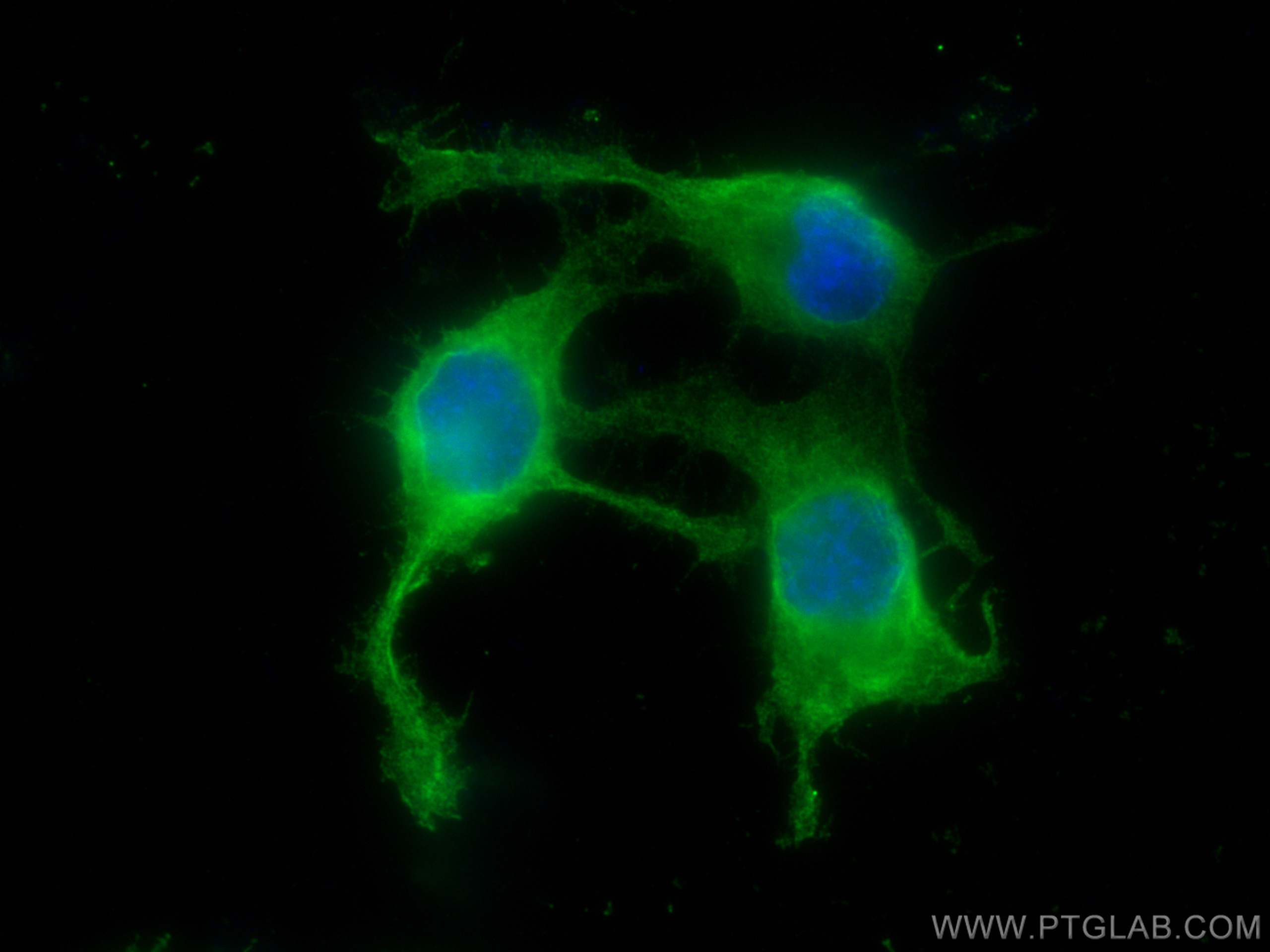 Immunofluorescence (IF) / fluorescent staining of Neuro-2a cells using PAK7 Monoclonal antibody (66961-1-Ig)