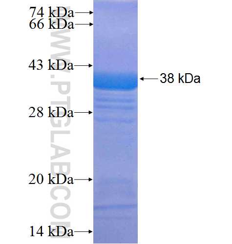 PAK7 fusion protein Ag25258 SDS-PAGE