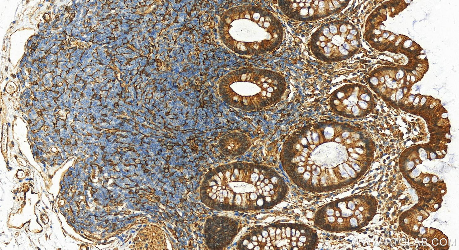 Immunohistochemistry (IHC) staining of human colon tissue using Palladin Polyclonal antibody (10853-1-AP)