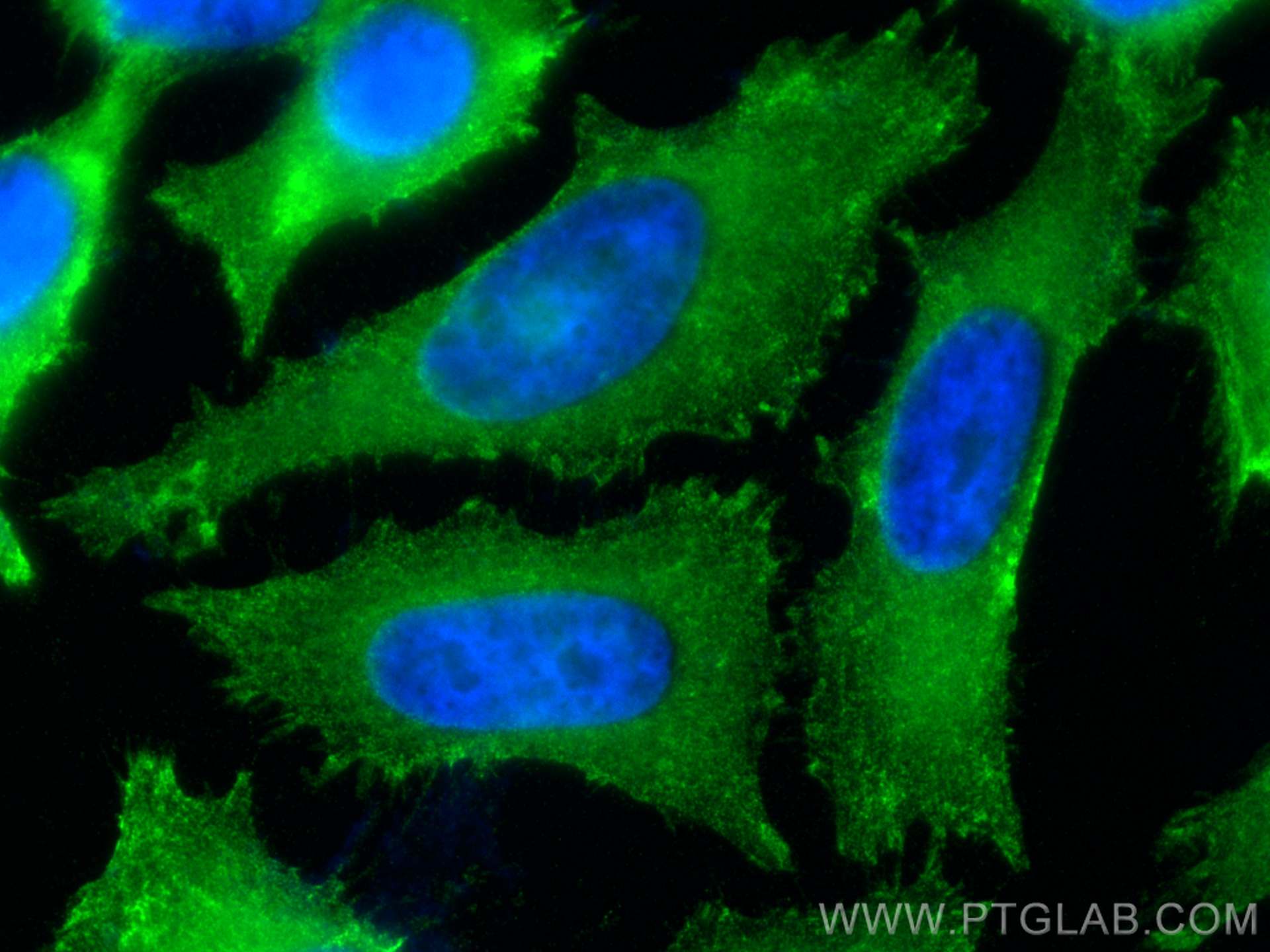 Immunofluorescence (IF) / fluorescent staining of HeLa cells using Palladin Polyclonal antibody (10853-1-AP)