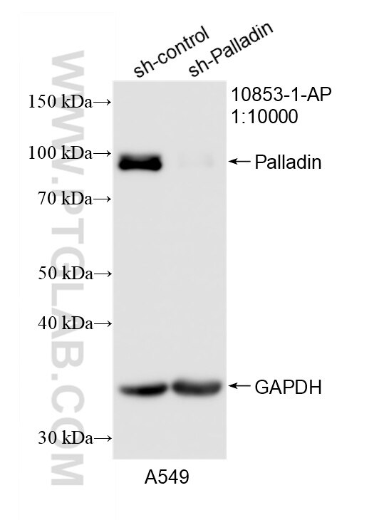 Western Blot (WB) analysis of A549 cells using Palladin Polyclonal antibody (10853-1-AP)