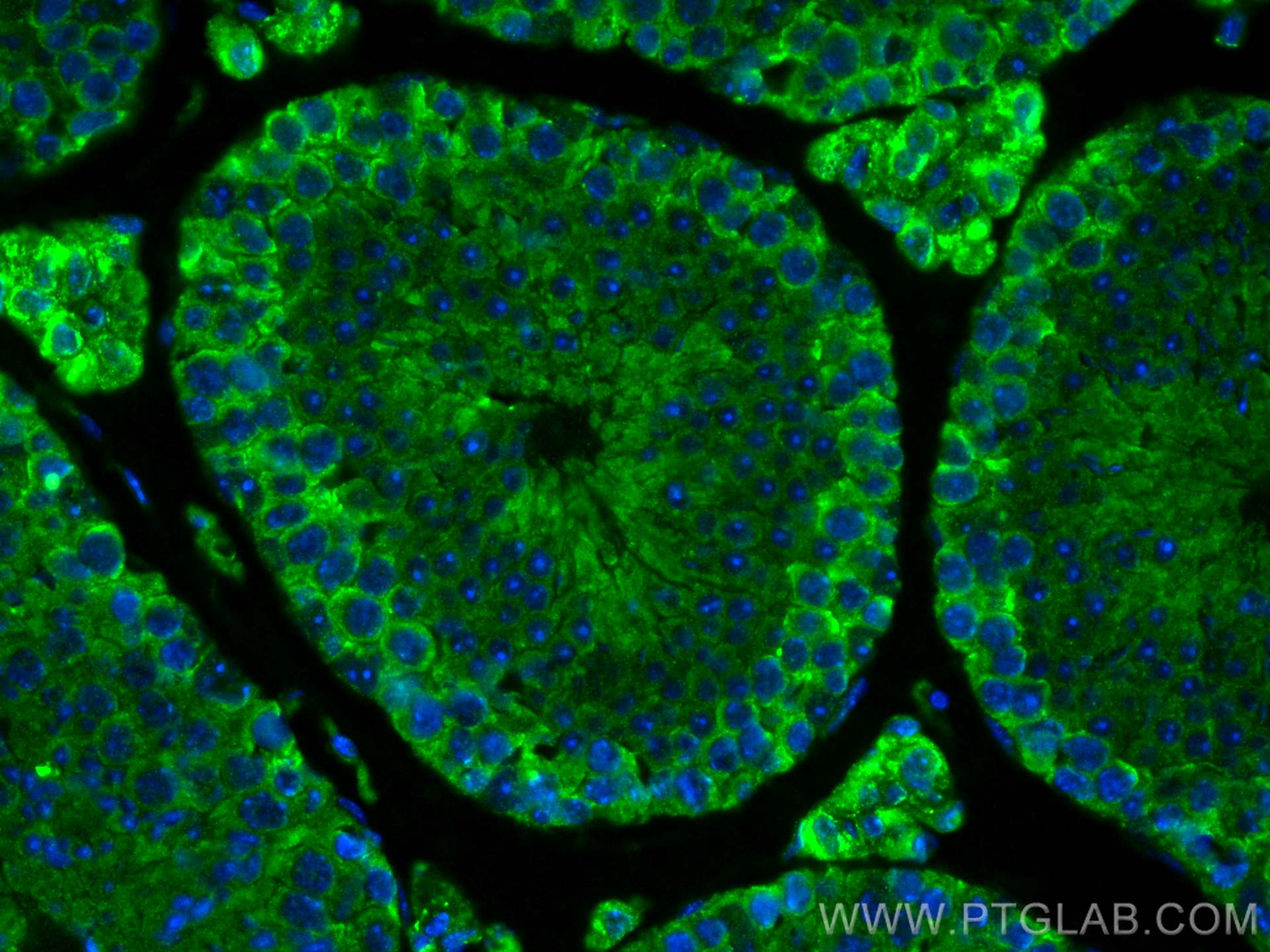 Immunofluorescence (IF) / fluorescent staining of mouse testis tissue using Palladin Monoclonal antibody (66601-1-Ig)
