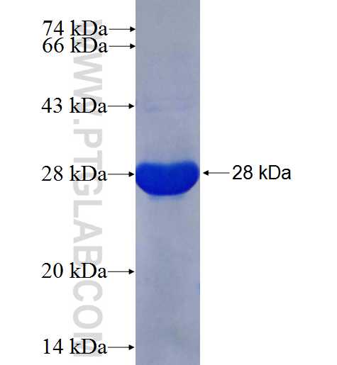 PALM fusion protein Ag25444 SDS-PAGE