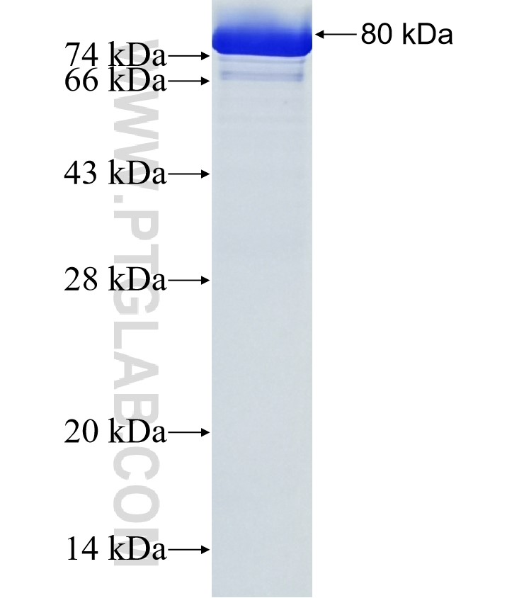 PALM fusion protein Ag36100 SDS-PAGE