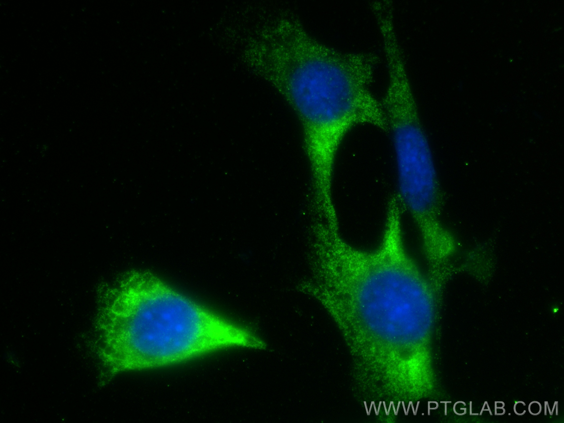 Immunofluorescence (IF) / fluorescent staining of NIH/3T3 cells using PAN2 Polyclonal antibody (16427-1-AP)