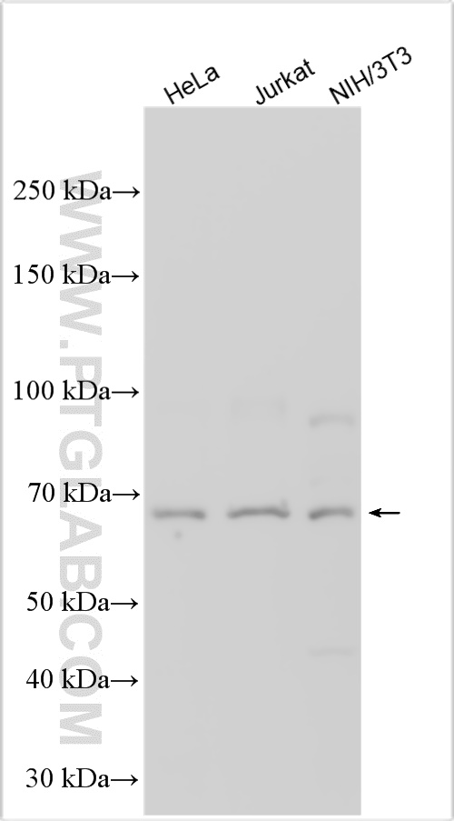 Western Blot (WB) analysis of various lysates using PAN3 Polyclonal antibody (25655-1-AP)