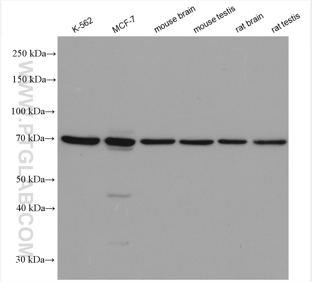 Western Blot (WB) analysis of various lysates using PANK2 Polyclonal antibody (11001-1-AP)