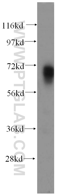 Western Blot (WB) analysis of human brain tissue using PAPOLB Polyclonal antibody (12821-1-AP)