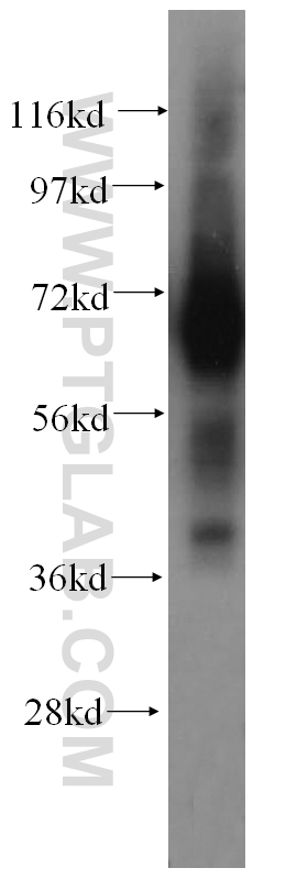 Western Blot (WB) analysis of mouse ovary tissue using PAPOLB Polyclonal antibody (12821-1-AP)