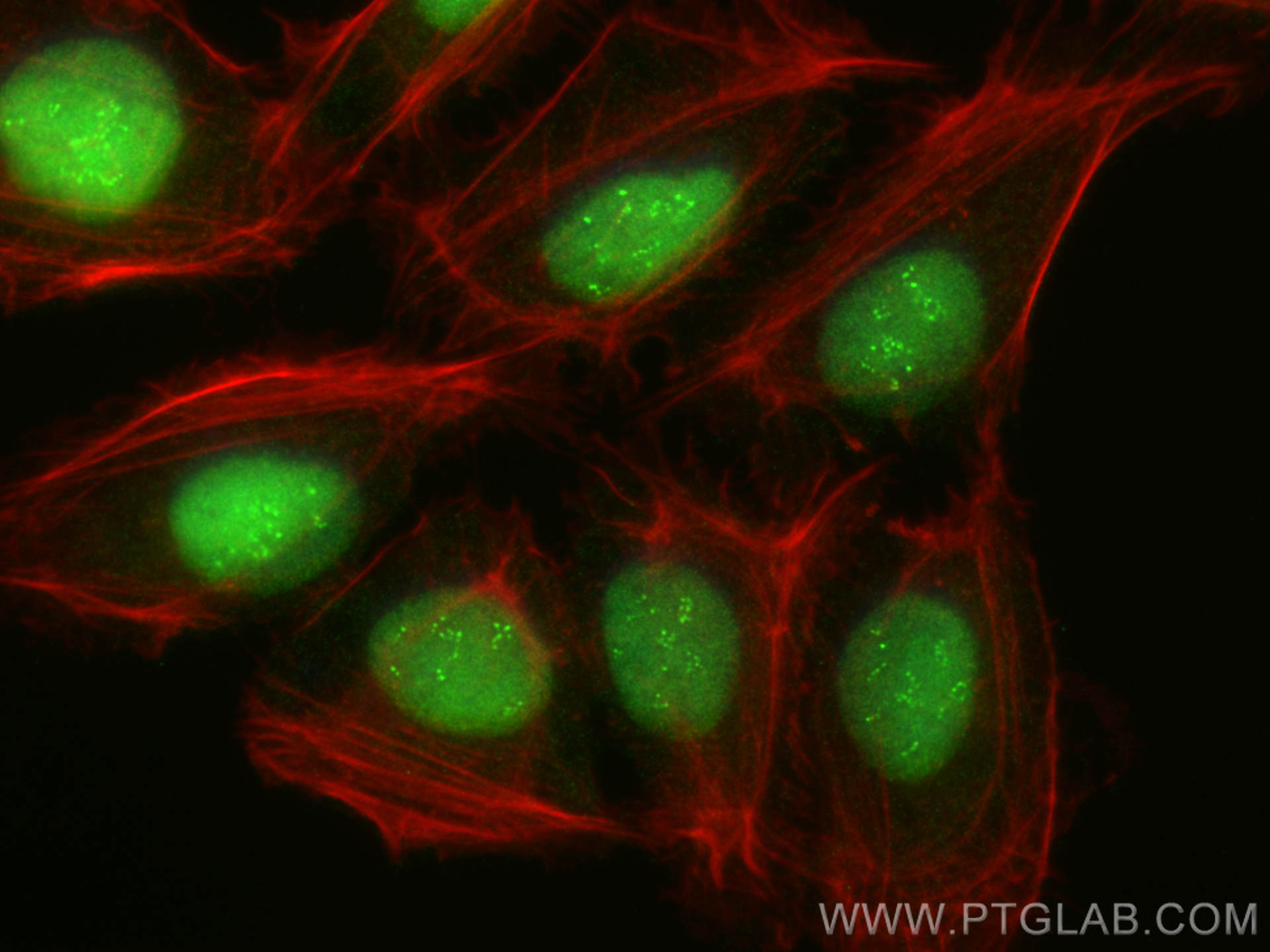 Immunofluorescence (IF) / fluorescent staining of U2OS cells using PAPSS1 Polyclonal antibody (14708-1-AP)